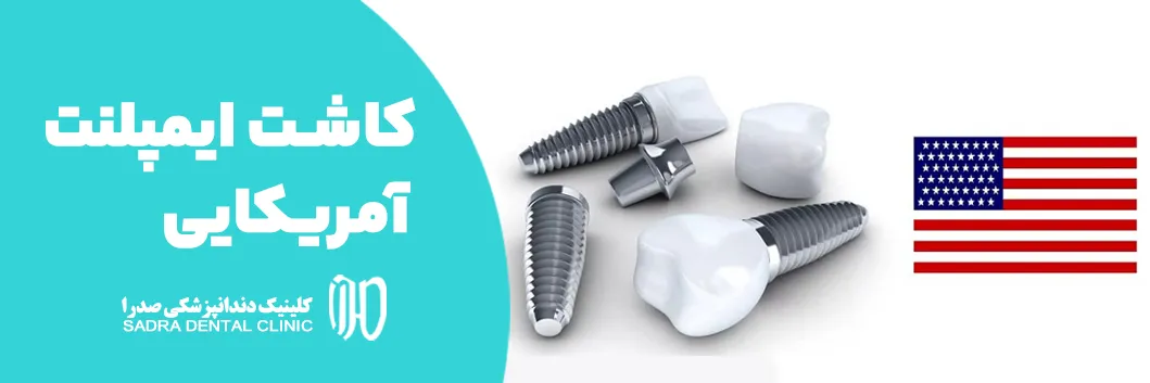 کاشت ایمپلنت آمریکایی در شیراز بهترین برند ایمپلنت آمریکایی مشاوره رایگان