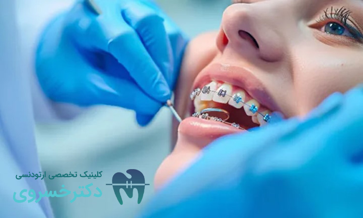 آینده درمان های ارتودنسی چگونه خواهد بود؟ - مطب تخصصی دندانپزشکی دکتر مهدیه خسروی