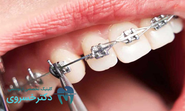 فناوری های نوین ارتودنسی: از CAD/CAM تا پرینت سه بعدی - مطب تخصصی دندانپزشکی دکتر مهدیه خسروی