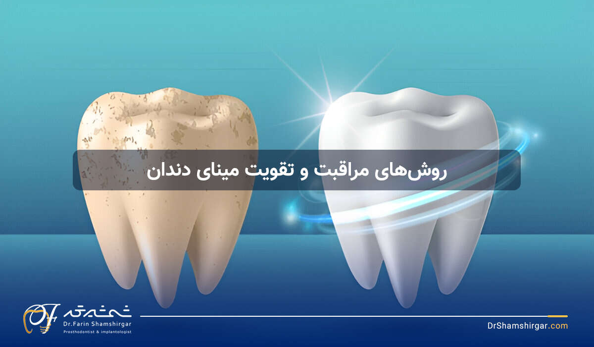 روش های تقویت مینای دندان 16 راه برای جلوگیری از فرسایش مینای دندان