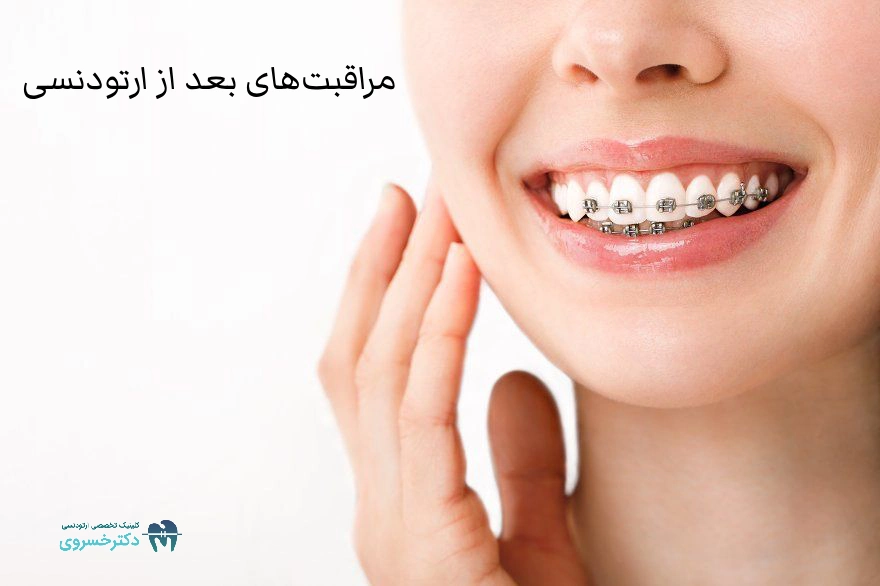 بعد از ارتودنسی: چه مراقبت هایی برای پایداری نتیجه لازم است؟