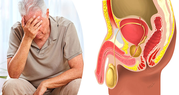 درمان پروستات در مردان - مرکز اورولوژی جهانشهر