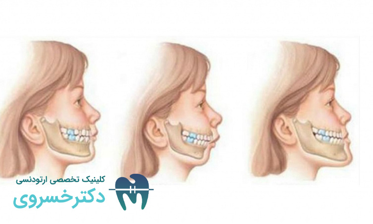 ارتباط بین ژنتیک و ناهنجاری های فک، ژن ها چگونه بر درمان ارتودنسی تاثیر می گذارند؟ - مطب تخصصی دندانپزشکی دکتر مهدیه خسروی