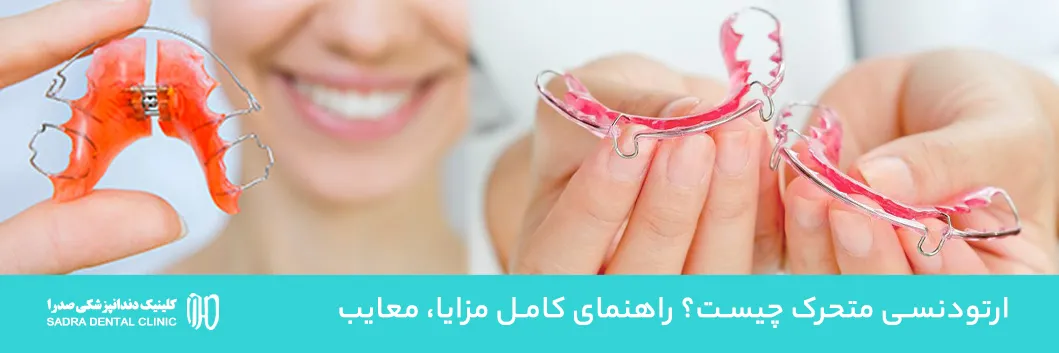 ارتودنسی متحرک چیست؟ راهنمای کامل مزایا، معایب + ارتودنسی متحرک در شیراز