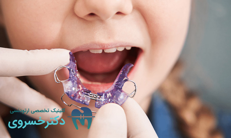 چرا از ارتودنسی متحرک برای کودکان استفاده کنیم؟