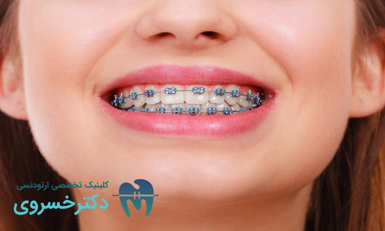 تاثیر ارتودنسی بر سلامت روان چیست؟