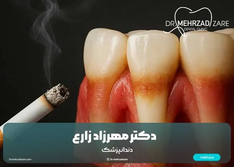 Gum health and smoking: effects, prevention and treatment