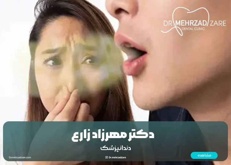 از بوی بد دهان جلوگیری کنید
