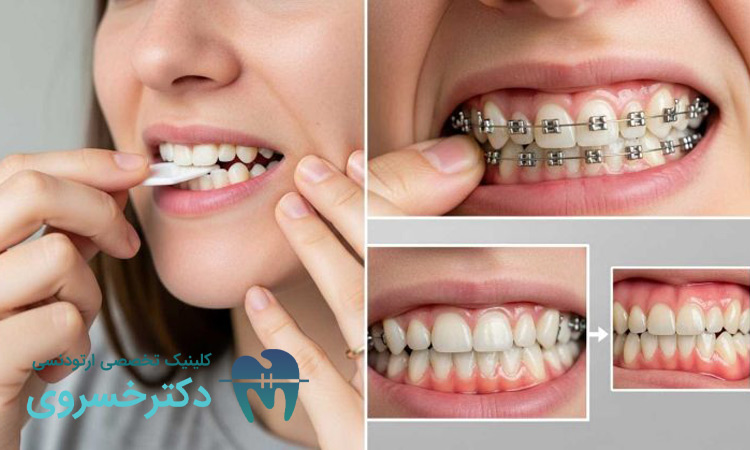 مهمترین تاثیر ارتودنسی بر سلامت عمومی بدن چیست؟ - مطب تخصصی دندانپزشکی دکتر مهدیه خسروی