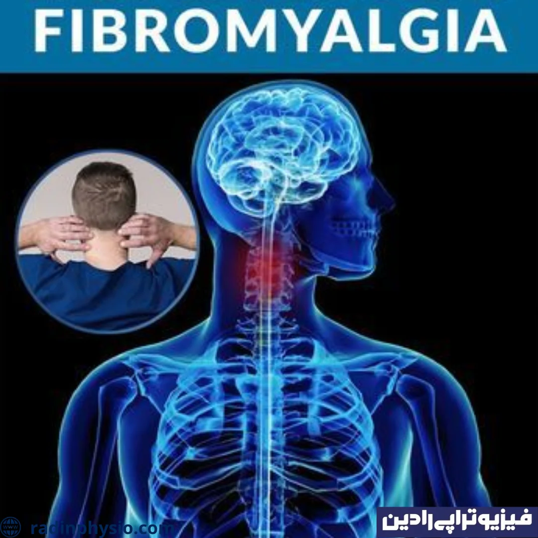 اختلال فیبرومیالژیا چیست و فیزیوتراپی چگونه به درمان آن کمک می کند؟ کلینیک فیزیوتراپی رادین