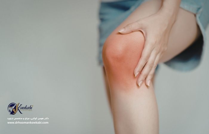 تورم زانو، تشخیص، علائم و درمان دکتر هومن کوکبی