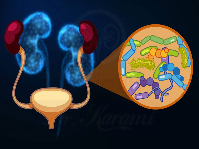 عفونت ادراری: علت ، علائم و درمان آن چیست؟