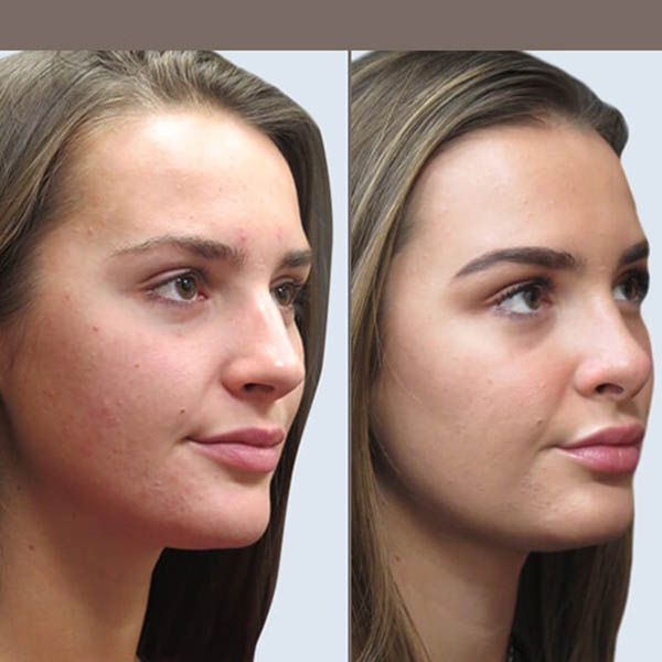 بهترین جراح بینی در تهران - دکتر حمیدرضا راستی