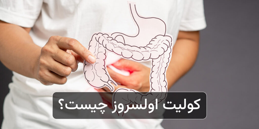 کولیت اولسراتیو چیست؟ بررسی علل، علائم و روش های درمانی تخصصی – کلینیک بیماری های التهابی روده