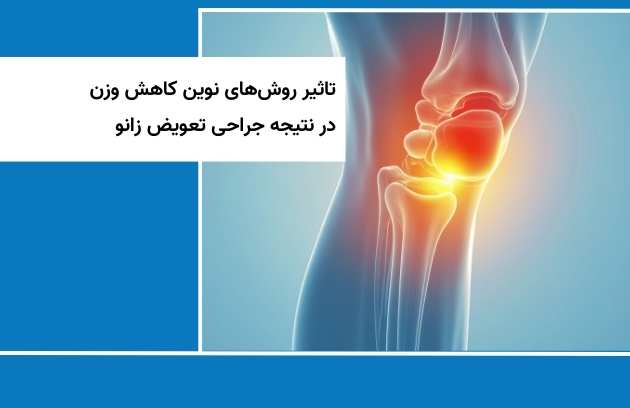 تأثير الطرق الجديدة لإنقاص الوزن نتيجة جراحة استبدال الركبة