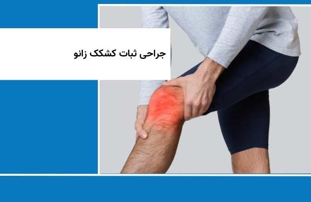 جراحة تثبيت الرضفة في الركبة