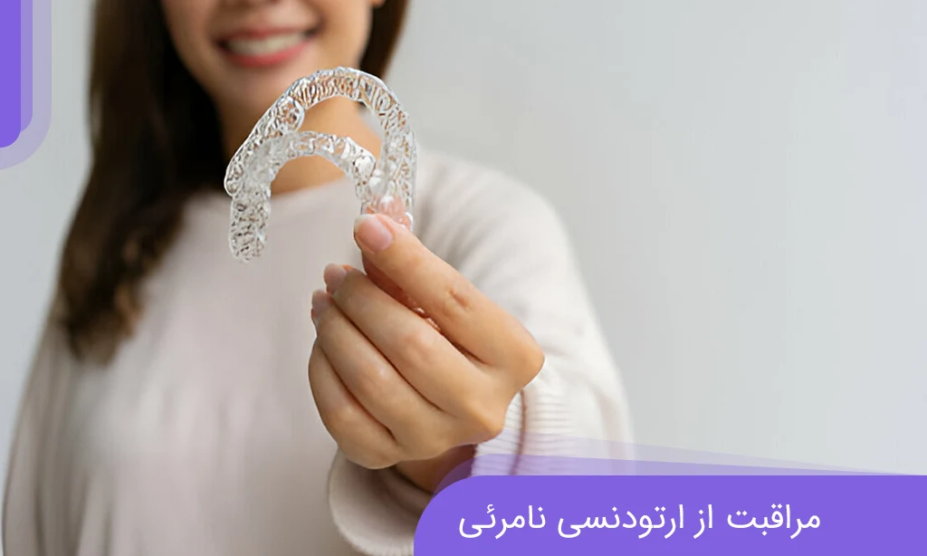 12 نصيحة للعناية بتقويم الأسنان غير المرئي (قائمة مراجعة الصيانة اليومية) | دكتور خداوي