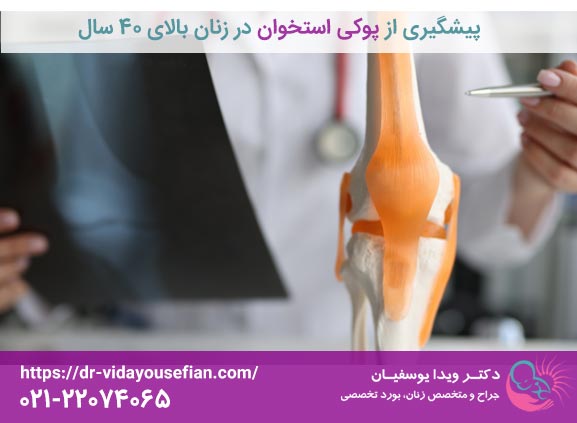 پیشگیری از پوکی استخوان در زنان بالای 40 سال - دکتر ویدا یوسفیان