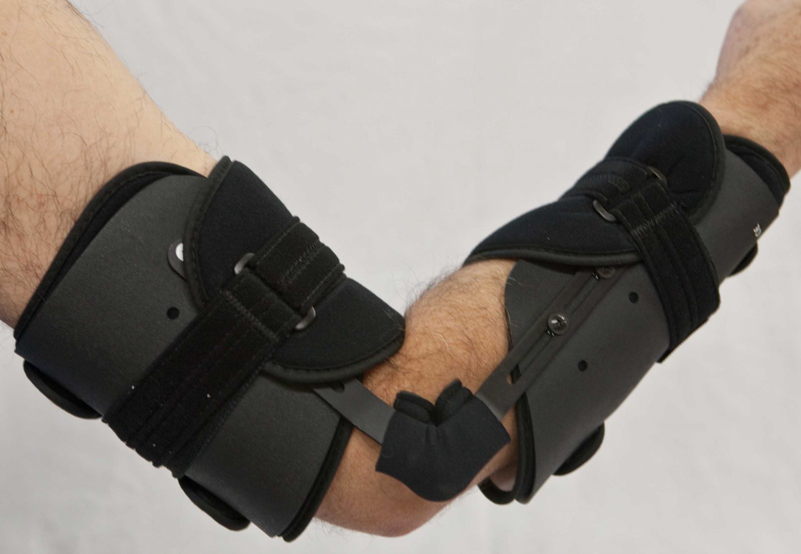 ارتز اندام فوقانی