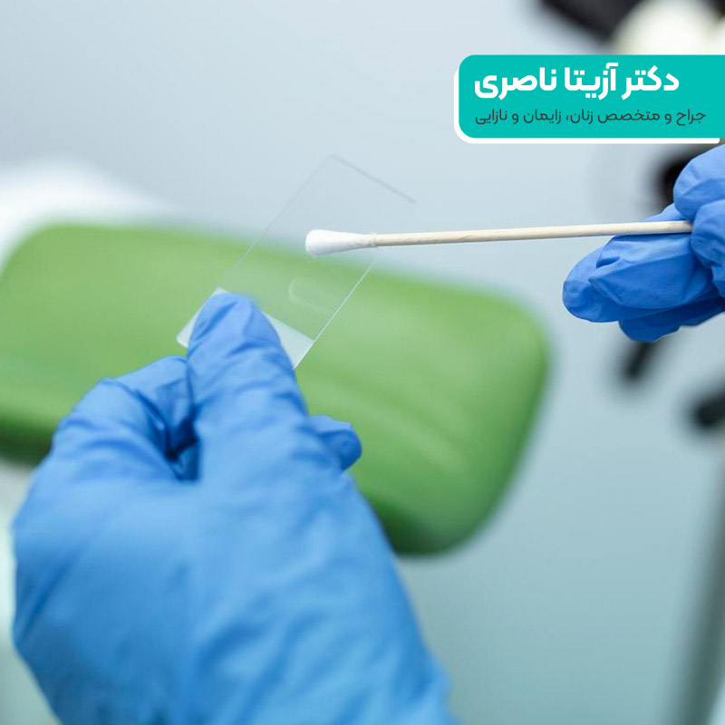 اختبار مسحة عنق الرحم