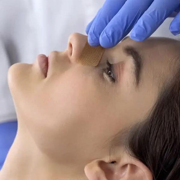 جراحی بینی بدون تامپون - دکتر حمیدرضا راستی