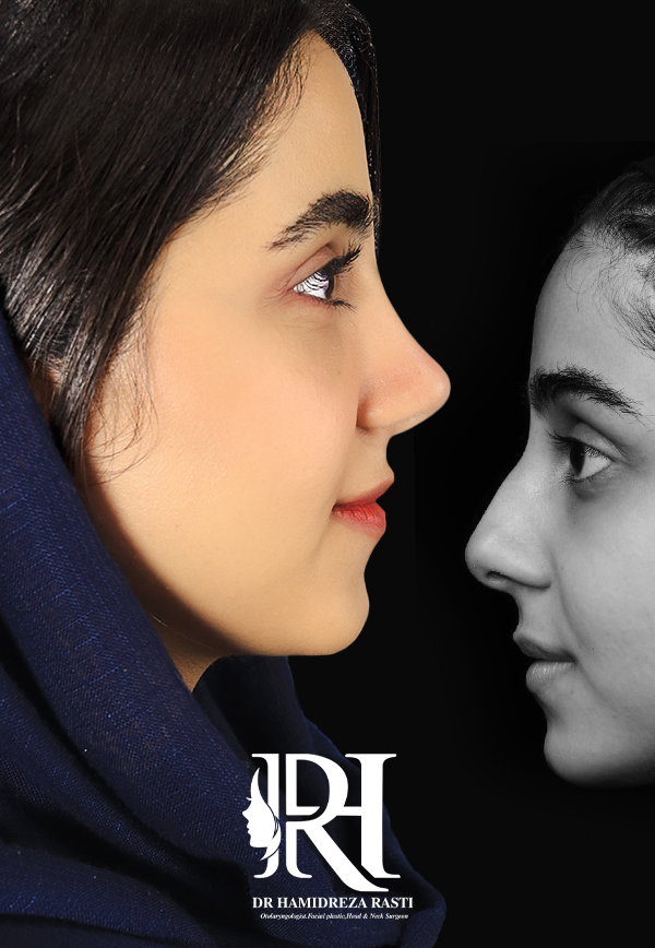 پیزوجراحی نسل جدید انقلابی در جراحی بینی - دکتر حمیدرضا راستی