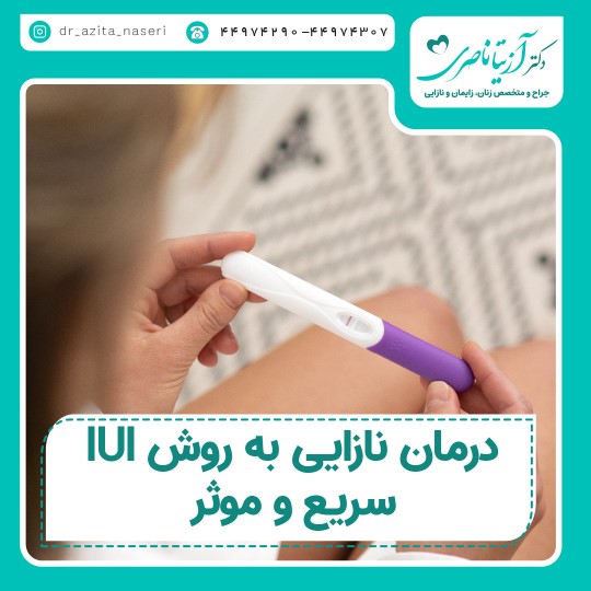 Infertility treatment by IUI method; Fast and effective