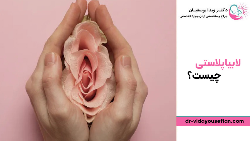 لابیاپلاستی چیست؟ و هزینه لابیاپلاستی چقدر است؟ - دکتر ویدا یوسفیان