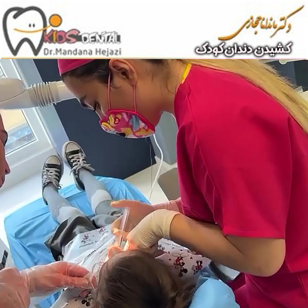 کشیدن دندان کودک دکتر ماندانا حجازی در تهران