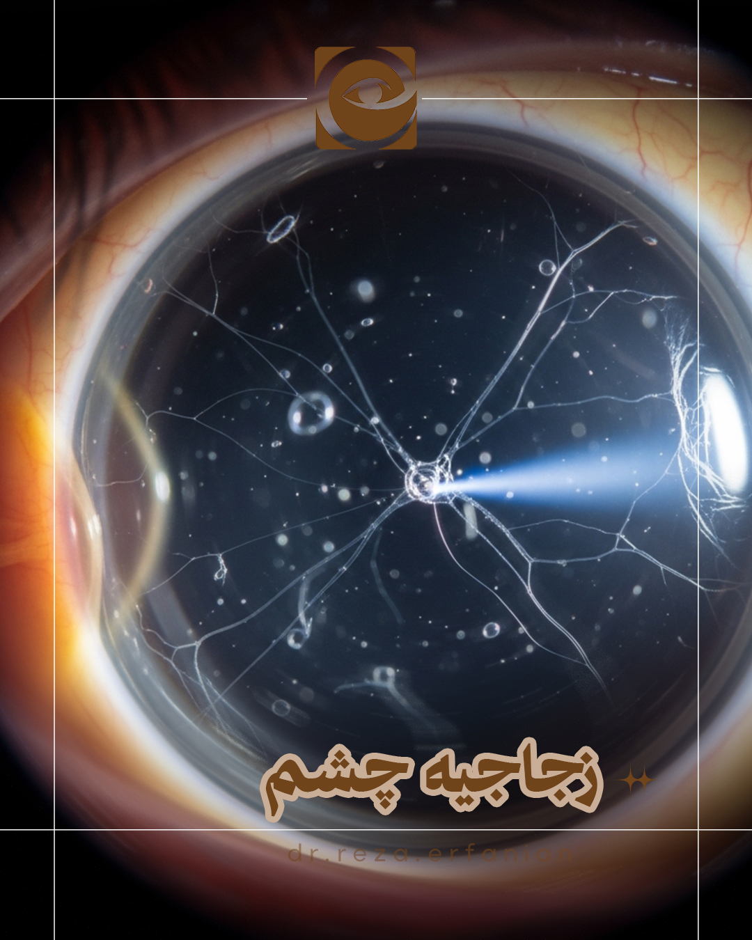 زجاجیه چیست؟