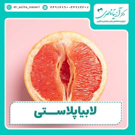 Labiaplasty or vaginal cosmetic surgery