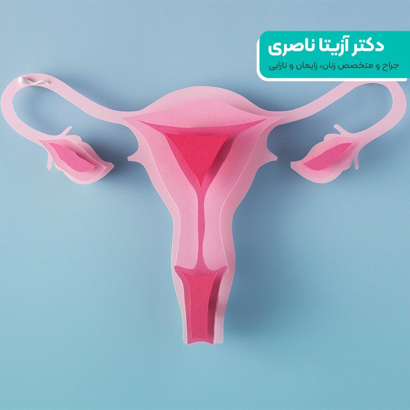 الأورام الليفية الرحمية