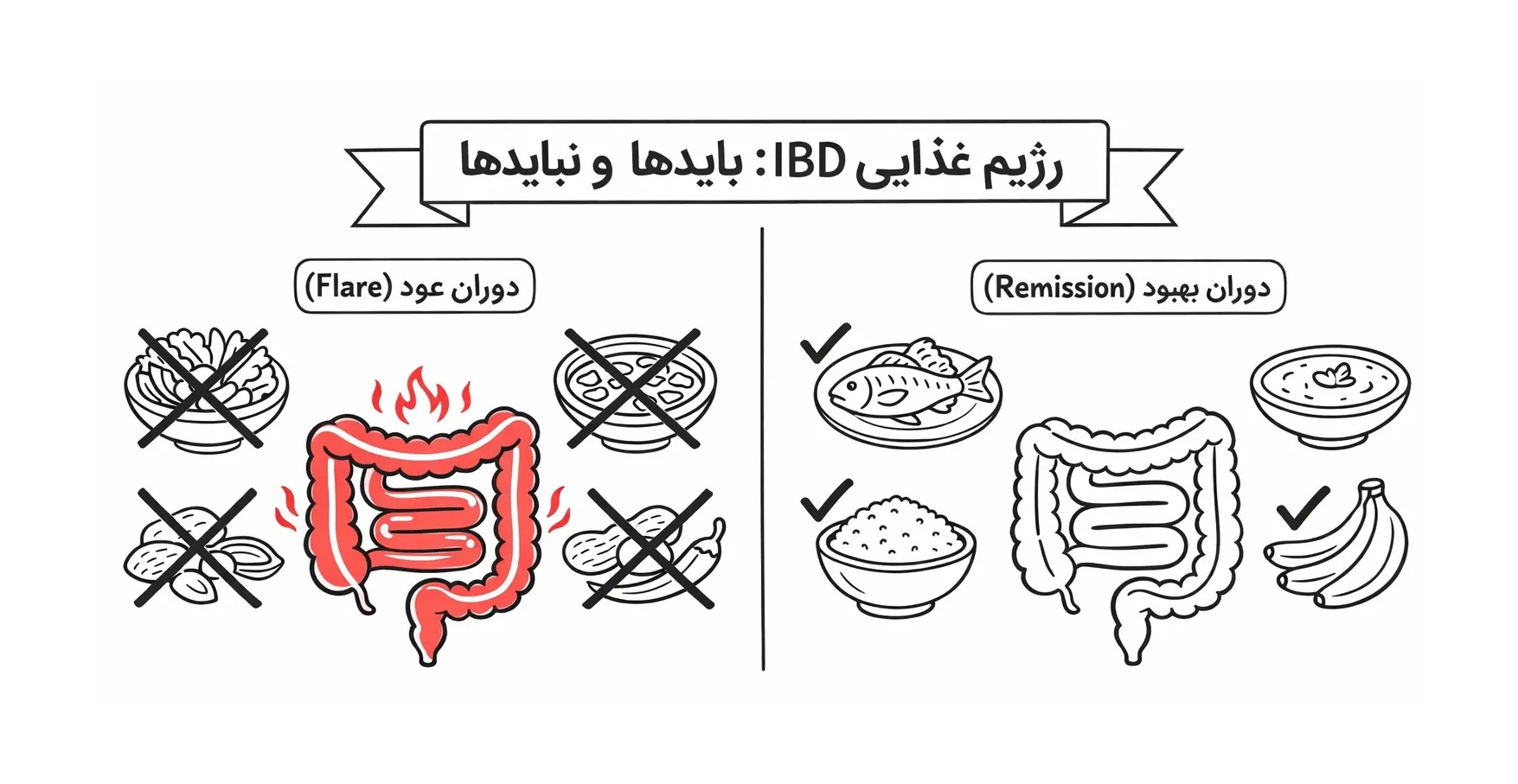 رژیم غذایی مناسب برای IBD در طول عود و بهبودی؛ چه بخوریم و چه نخوریم؟ چرا مناسب است؟ - کلینیک بیماریهای التهابی روده