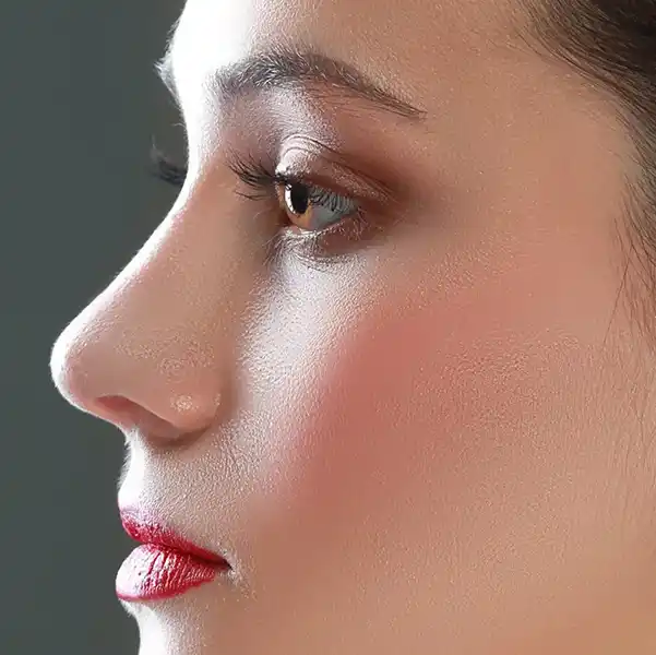 بهترین جراح بینی در تهران - دکتر حمیدرضا راستی