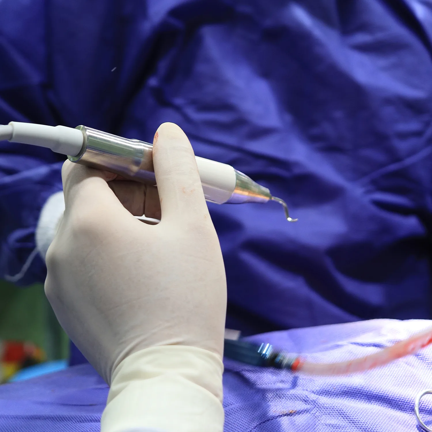 پیزوجراحی جدیدترین روش جراحی بینی - دکتر حمیدرضا راستی