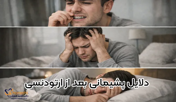 دلیل پشیمانی بعد از ارتودنسی چیست؟