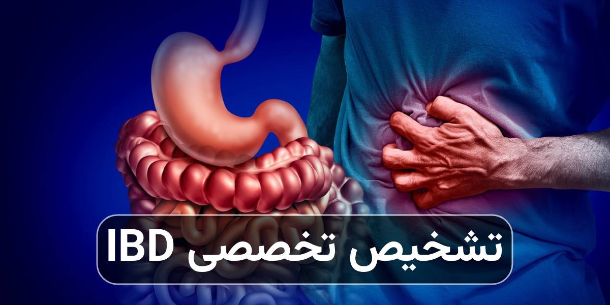 تشخیص تخصصی IBD؛ تفاوت بین کرون و کولیت اولسراتیو - کلینیک بیماری های التهابی روده