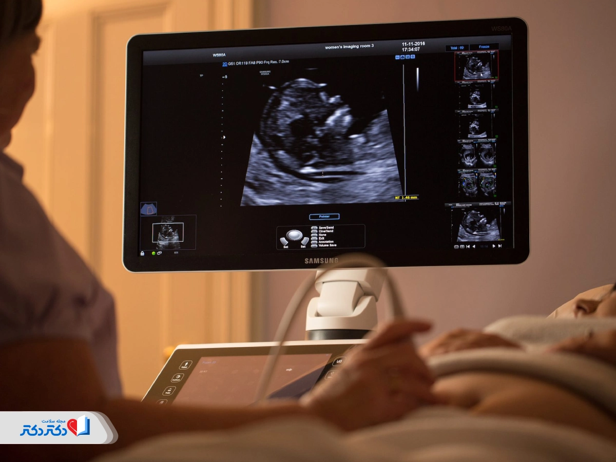 فحص الموجات فوق الصوتية NT لتشوهات الكروموسومات الجنينية أثناء الحمل