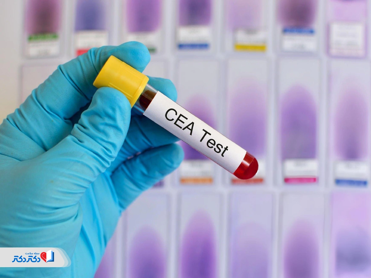 ما هو فحص الدم CEA؟ النطاق الطبيعي وتطبيقاته