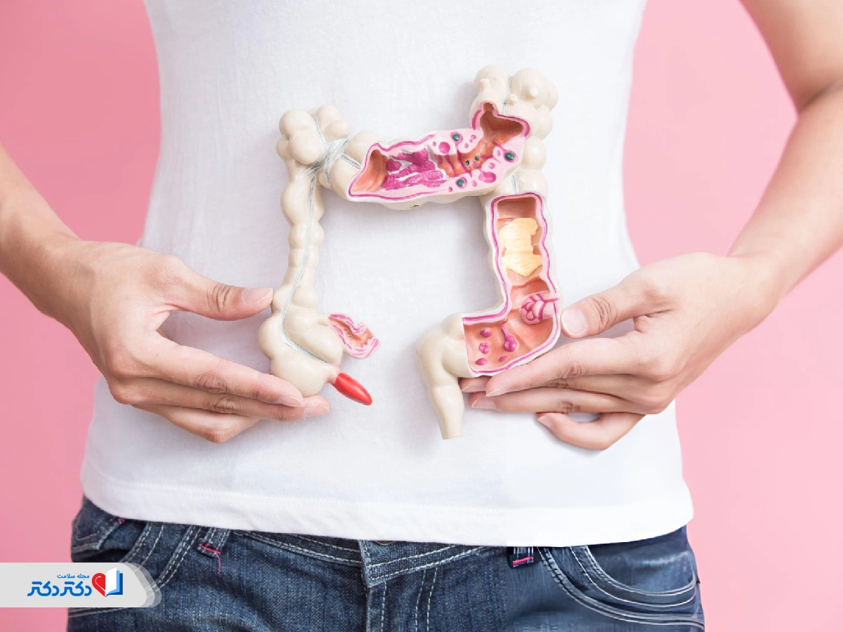 اختبار سرطان الأمعاء في المنزل. طرق وعلامات وتفسير الاختبارات