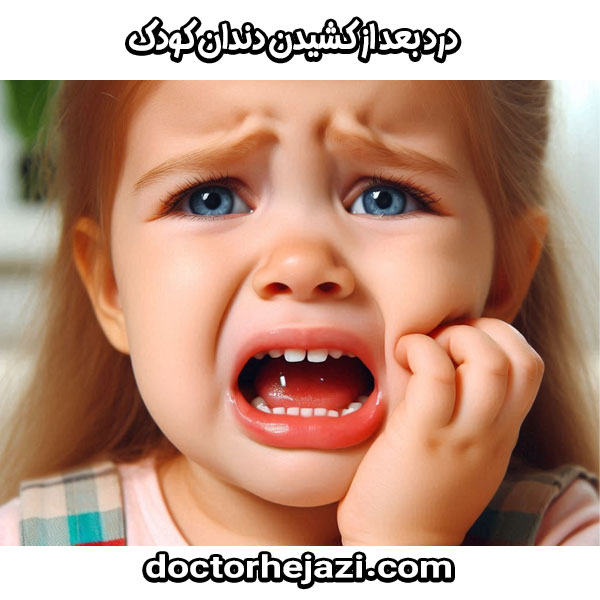 درد بعد از کشیدن دندان دکتر ماندانا حجازی