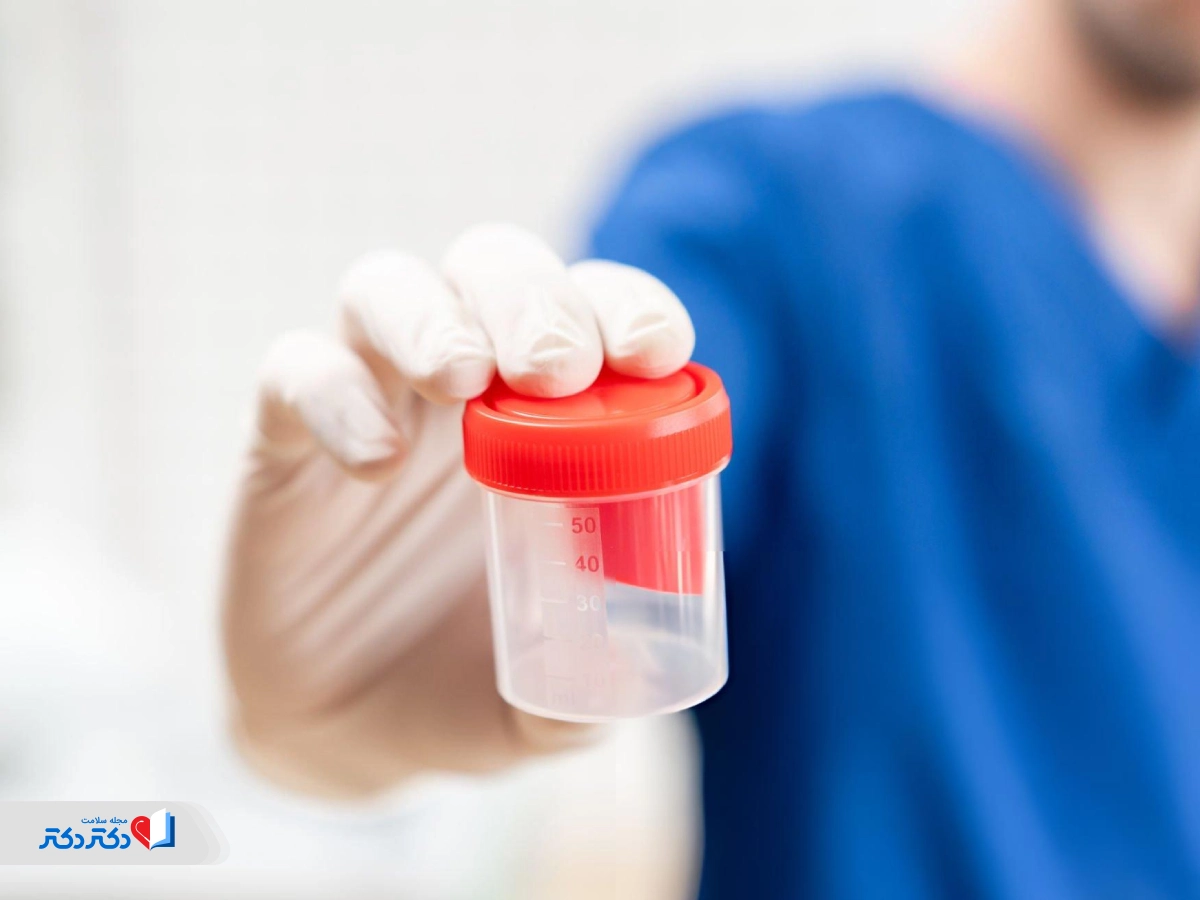 ما هو اختبار الإدمان؟ طرق وكيفية الأداء وتكلفة اختبار الإدمان