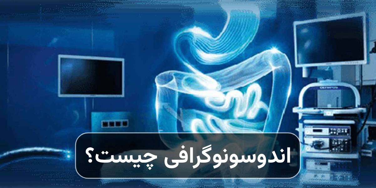ما هو التصوير الداخلي (EUS) وما هو استخدامه؟ - عيادة أمراض الأمعاء الالتهابية