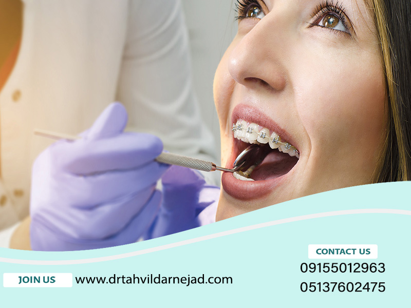 فواید ارتودنسی و خطرات احتمالی آن برای دندان |