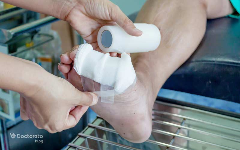 همه بایدها و نبایدها در مورد نحوه پانسمان زخم پای دیابتی