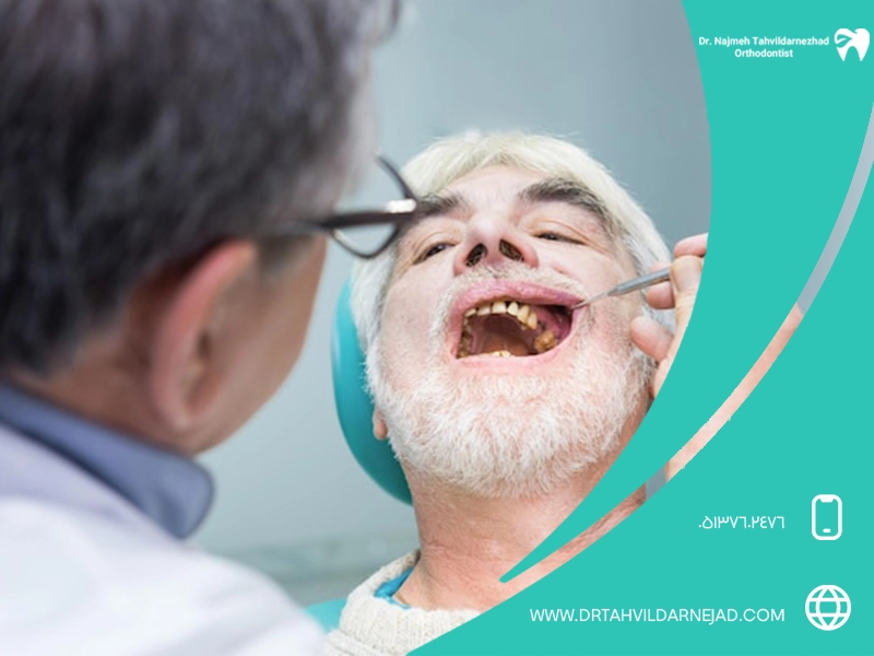 درمان پرکردگی های قدیمی دندان + روش های جایگزینی و ترمیم