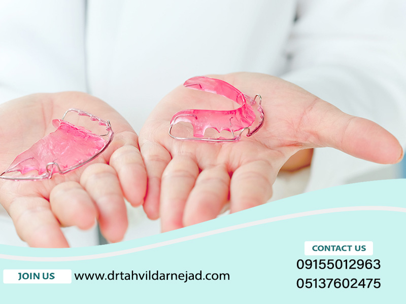 ارتودنسی با گشاد کننده کام: هر آنچه که باید بدانید!| دکتر زادرودرنژاد