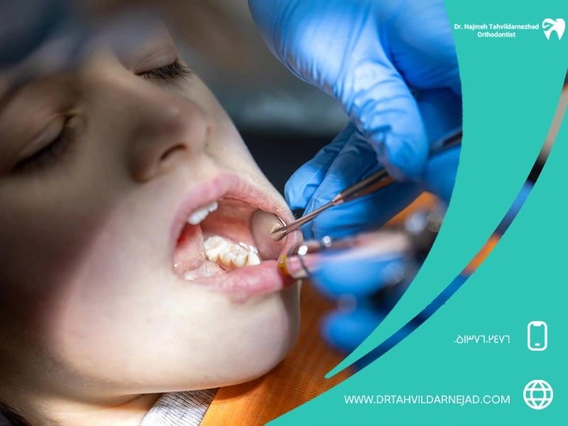 عصب کشی دندان چیست؟ علائم، مراحل و مراقبت های لازم