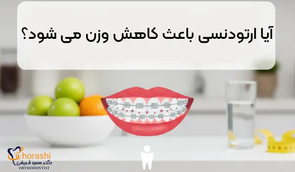 ارتودنسی و لاغری | آیا ارتودنسی باعث کاهش وزن می شود؟