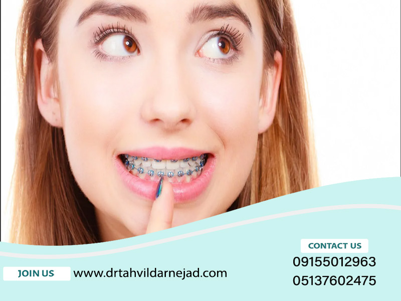 راهنمای مراقبت از دندان های ارتودنسی دکتر زادرودرنژاد